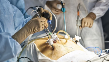 جراحی لاپاراسکوپی